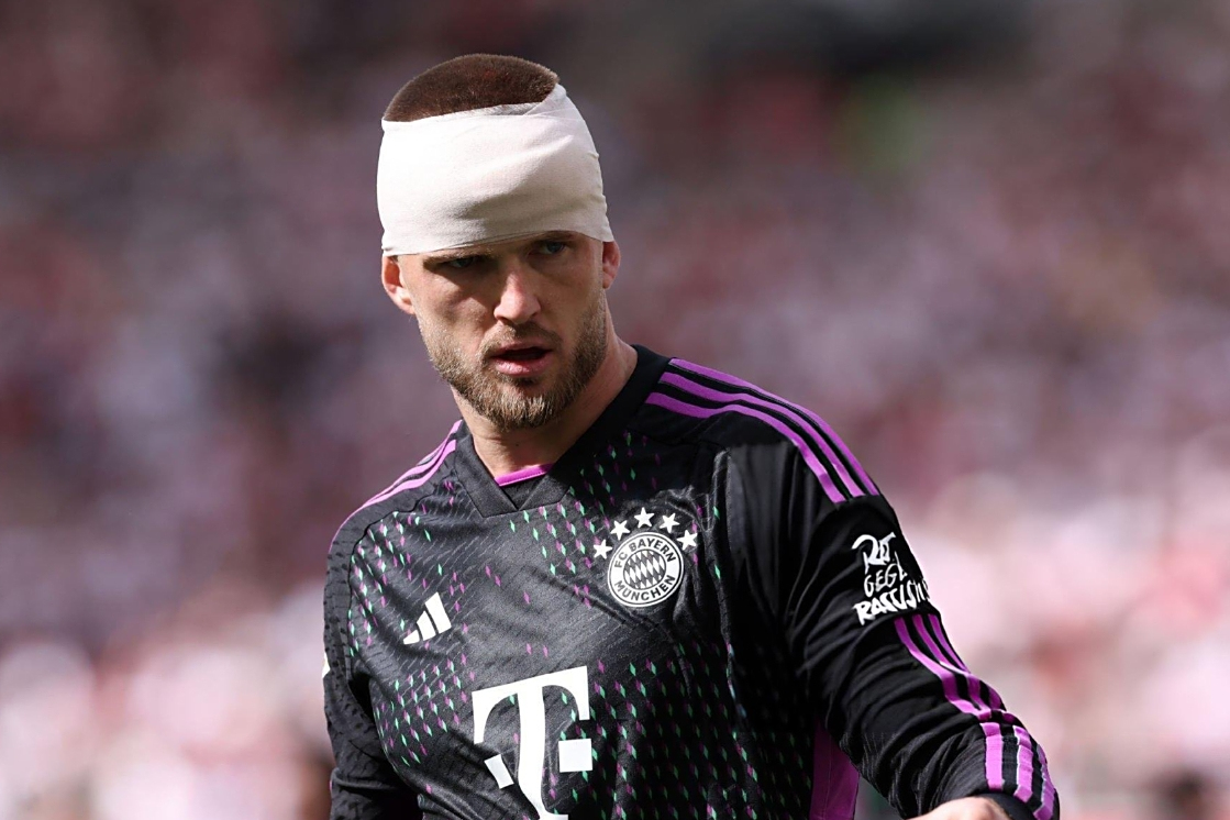 拜仁慕尼黑主力中卫受伤,缺战数场比赛的简单介绍 拜仁慕尼黑主力中卫受伤,缺战数场比赛的简单介绍